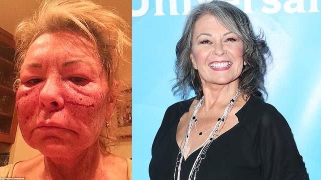 Rosanne Barr